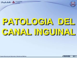 PATOLOGIA DEL
CANAL INGUINAL
 