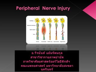 Peripheral  Nerve Injury ,[object Object],[object Object],[object Object],[object Object]