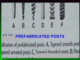 PREFABRICATED POSTS 