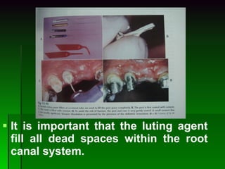 It is important that the luting agent fill all dead spaces within the root canal system. 