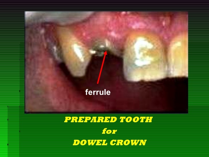 3. post retained crownmidterm3