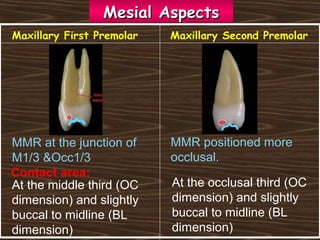 Maxillary First Premolar Maxillary Second Premolar
Mesial AspectsMesial Aspects
At the occlusal third (OC
dimension) and slightly
buccal to midline (BL
dimension)
MMR positioned more
occlusal.
Contact area:
At the middle third (OC
dimension) and slightly
buccal to midline (BL
dimension)
MMR at the junction of
M1/3 &Occ1/3
 
