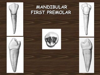 MANDIBULARMANDIBULAR
FIRST PREMOLARFIRST PREMOLAR
 