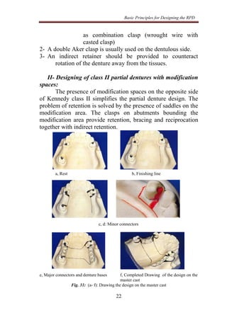 Wrought Wire Rpd 3-principles of design.pdf