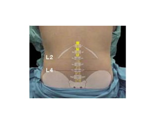 3 punció lumbar