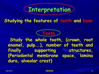 05/19/1605/19/16 OelshallOelshall 1010
InterpretationInterpretation
Studying the features ofStudying the features of teethteeth andand bonebone
TeethTeeth
Study the whole tooth, (crown, rootStudy the whole tooth, (crown, root
enamel, pulp….), number of teeth andenamel, pulp….), number of teeth and
finally supporting structures,finally supporting structures,
(Periodontal membrane space, lamina(Periodontal membrane space, lamina
dura, alveolar crest)dura, alveolar crest)
 