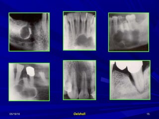 05/19/1605/19/16 OelshallOelshall 1515
 