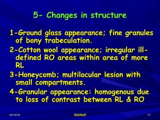 05/19/1605/19/16 OelshallOelshall 1717
5- Changes in structure5- Changes in structure
1-Ground glass appearance; fine granules1-Ground glass appearance; fine granules
of bony trabeculation.of bony trabeculation.
2-Cotton wool appearance; irregular ill-2-Cotton wool appearance; irregular ill-
defined RO areas within area of moredefined RO areas within area of more
RLRL
3-Honeycomb; multilocular lesion with3-Honeycomb; multilocular lesion with
small compartments.small compartments.
4-Granular appearance: homogenous due4-Granular appearance: homogenous due
to loss of contrast between RL & ROto loss of contrast between RL & RO
 