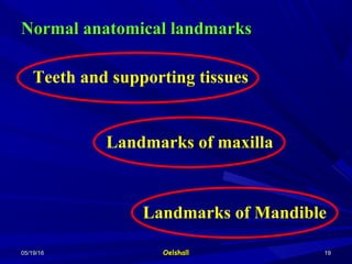 05/19/1605/19/16 OelshallOelshall 1919
Teeth and supporting tissues
Landmarks of maxilla
Landmarks of Mandible
Normal anatomical landmarksNormal anatomical landmarks
 