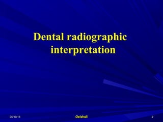 05/19/1605/19/16 OelshallOelshall 22
Dental radiographic
interpretation
 