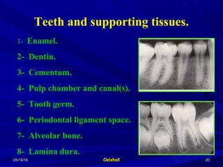 05/19/1605/19/16 OelshallOelshall 2020
1-  Enamel.
2- Dentin.
3- Cementum.
4- Pulp chamber and canal(s).
5- Tooth germ.
6- Periodontal ligament space.
7- Alveolar bone.
8- Lamina dura.
Teeth and supporting tissues.
 