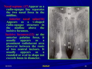 05/19/1605/19/16 OelshallOelshall 2828
Nasal septum: (17)Appear as a
radio-opaque line separates
the two nasal fossa in the
midline.
Anterior nasal spine(16)
Appears as a v-shaped
radio-opaque structure in
the midline above the
incisive foramen.
Incisive foramen:(12) or the
anterior palatine fossa, it
usually appears as a
prominent radiolucent area
above/or between the roots
of two central incisors. It
usually appears as a
rounded or oval in shape not
exceeds 6mm in diameter.
 