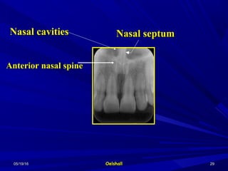 05/19/1605/19/16 OelshallOelshall 2929
Anterior nasal spineAnterior nasal spine
Nasal cavitiesNasal cavities Nasal septumNasal septum
 