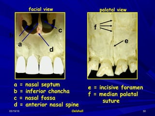 05/19/1605/19/16 OelshallOelshall 3030
e
f
a = nasal septum
b = inferior choncha
c = nasal fossa
d = anterior nasal spine
e = incisive foramen
f = median palatal
suture
a
d
c
facial view palatal view
b
 