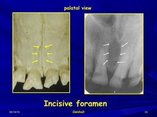 05/19/1605/19/16 OelshallOelshall 3333
Incisive foramen
palatal view
 