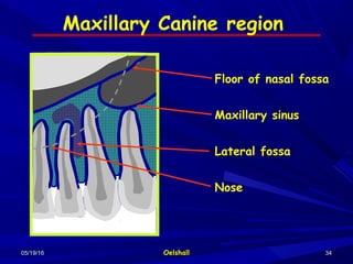 05/19/1605/19/16 OelshallOelshall 3434
Maxillary Canine region
Floor of nasal fossa
Maxillary sinus
Lateral fossa
Nose
 