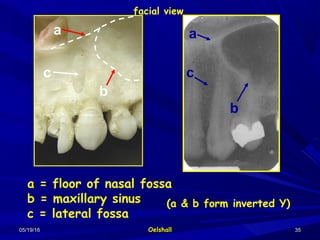 05/19/1605/19/16 OelshallOelshall 3535
a = floor of nasal fossa
b = maxillary sinus
c = lateral fossa
(a & b form inverted Y)
a
c
b
a
c
b
facial view
 