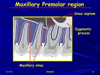05/19/1605/19/16 OelshallOelshall 3838
Zygomatic
process
Sinus septum
Maxillary sinus
Maxillary Premolar region
 