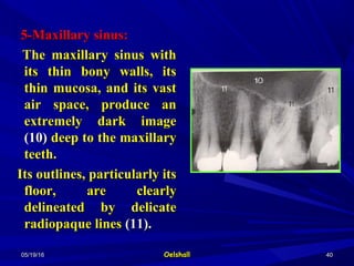 05/19/1605/19/16 OelshallOelshall 4040
5-Maxillary sinus:5-Maxillary sinus:
The maxillary sinus withThe maxillary sinus with
its thin bony walls, itsits thin bony walls, its
thin mucosa, and its vastthin mucosa, and its vast
air space, produce anair space, produce an
extremely dark imageextremely dark image
(10)(10) deep to the maxillarydeep to the maxillary
teeth.teeth.
Its outlines, particularly itsIts outlines, particularly its
floor, are clearlyfloor, are clearly
delineated by delicatedelineated by delicate
radiopaque linesradiopaque lines (11).(11).
 