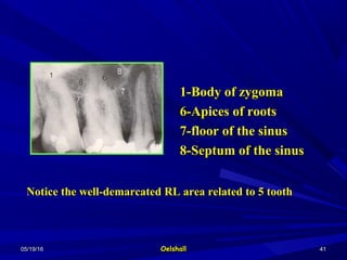 05/19/1605/19/16 OelshallOelshall 4141
1-Body of zygoma1-Body of zygoma
6-Apices of roots6-Apices of roots
7-floor of the sinus7-floor of the sinus
8-Septum of the sinus8-Septum of the sinus
Notice the well-demarcated RL area related to 5 toothNotice the well-demarcated RL area related to 5 tooth
 