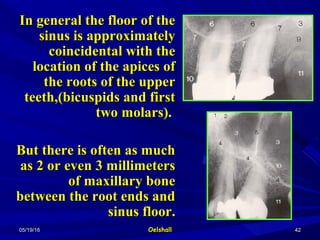 05/19/1605/19/16 OelshallOelshall 4242
In general the floor of theIn general the floor of the
sinus is approximatelysinus is approximately
coincidental with thecoincidental with the
location of the apices oflocation of the apices of
the roots of the upperthe roots of the upper
teeth,(bicuspids and firstteeth,(bicuspids and first
two molars).two molars).
But there is often as muchBut there is often as much
as 2 or even 3 millimetersas 2 or even 3 millimeters
of maxillary boneof maxillary bone
between the root ends andbetween the root ends and
sinus floor.sinus floor.
 