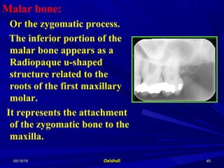 05/19/1605/19/16 OelshallOelshall 4545
Malar bone:
Or the zygomatic process.
The inferior portion of the
malar bone appears as a
Radiopaque u-shaped
structure related to the
roots of the first maxillary
molar.
It represents the attachment
of the zygomatic bone to the
maxilla.
 