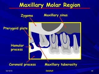 05/19/1605/19/16 OelshallOelshall 4848
Maxillary Molar Region
Maxillary sinusZygoma
Pterygoid plate
Hamular
process
Coronoid process Maxillary tuberosity
 