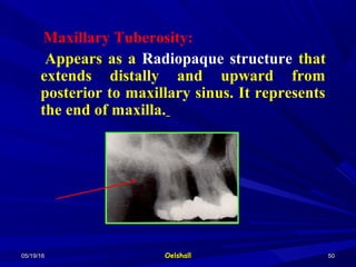 05/19/1605/19/16 OelshallOelshall 5050
Maxillary Tuberosity:
Appears as a Radiopaque structure that
extends distally and upward from
posterior to maxillary sinus. It represents
the end of maxilla.
 