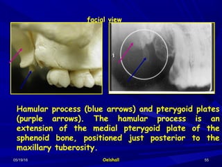 05/19/1605/19/16 OelshallOelshall 5555
Hamular process (blue arrows) and pterygoid plates
(purple arrows). The hamular process is an
extension of the medial pterygoid plate of the
sphenoid bone, positioned just posterior to the
maxillary tuberosity.
facial view
 