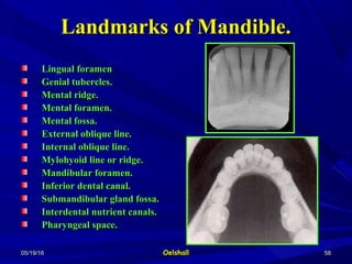 05/19/1605/19/16 OelshallOelshall 5858
Landmarks of Mandible.Landmarks of Mandible.
Lingual foramenLingual foramen
Genial tubercles.Genial tubercles.
Mental ridge.Mental ridge.
Mental foramen.Mental foramen.
Mental fossa.Mental fossa.
External oblique line.External oblique line.
Internal oblique line.Internal oblique line.
Mylohyoid line or ridge.Mylohyoid line or ridge.
Mandibular foramen.Mandibular foramen.
Inferior dental canal.Inferior dental canal.
Submandibular gland fossa.Submandibular gland fossa.
Interdental nutrient canals.Interdental nutrient canals.
Pharyngeal space.Pharyngeal space.
 