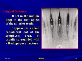 05/19/1605/19/16 OelshallOelshall 6060
Lingual foramen:
It set in the midline
deep to the root apices
of the anterior teeth.
It appears as a small
radiolucent dot at the
symphysis area. It
usually surrounded with
a Radiopaque structure.
 