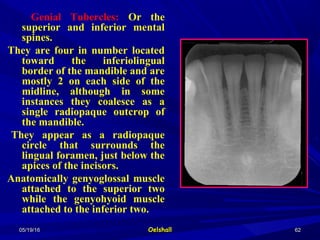 05/19/1605/19/16 OelshallOelshall 6262
Genial Tubercles: Or the
superior and inferior mental
spines.
They are four in number located
toward the inferiolingual
border of the mandible and are
mostly 2 on each side of the
midline, although in some
instances they coalesce as a
single radiopaque outcrop of
the mandible.
They appear as a radiopaque
circle that surrounds the
lingual foramen, just below the
apices of the incisors.
Anatomically genyoglossal muscle
attached to the superior two
while the genyohyoid muscle
attached to the inferior two.
 