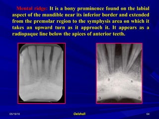 05/19/1605/19/16 OelshallOelshall 6464
Mental ridge:Mental ridge: It is a bony prominence found on the labialIt is a bony prominence found on the labial
aspect of the mandible near its inferior border and extendedaspect of the mandible near its inferior border and extended
from the premolar region to the symphysis area on which itfrom the premolar region to the symphysis area on which it
takes an upward turn as it approach it. It appears as atakes an upward turn as it approach it. It appears as a
radiopaque line below the apices of anterior teeth.radiopaque line below the apices of anterior teeth.
 