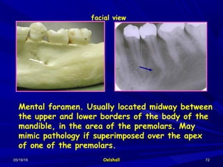 05/19/1605/19/16 OelshallOelshall 7272
Mental foramen. Usually located midway between
the upper and lower borders of the body of the
mandible, in the area of the premolars. May
mimic pathology if superimposed over the apex
of one of the premolars.
facial view
 