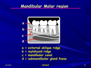 05/19/1605/19/16 OelshallOelshall 7373
Mandibular Molar region
a = external oblique ridge
b = mylohyoid ridge
c = mandibular canal
d = submandibular gland fossa
 
