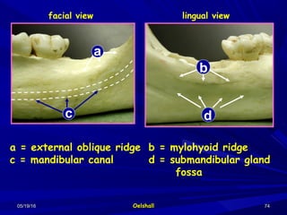 05/19/1605/19/16 OelshallOelshall 7474
facial view lingual view
b
c
a
b
a = external oblique ridge
c = mandibular canal
b = mylohyoid ridge
d = submandibular gland
fossa
dd
 