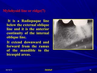 05/19/1605/19/16 OelshallOelshall 7878
Mylohyoid line or ridge(7)
It is a Radiopaque line
below the external oblique
line and it is the anterior
continuity of the internal
oblique line.
It extend downward and
forward from the ramus
of the mandible to the
bicuspid areas.
 