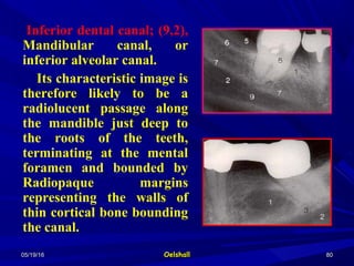 05/19/1605/19/16 OelshallOelshall 8080
Inferior dental canal; (9,2),
Mandibular canal, or
inferior alveolar canal.
Its characteristic image is
therefore likely to be a
radiolucent passage along
the mandible just deep to
the roots of the teeth,
terminating at the mental
foramen and bounded by
Radiopaque margins
representing the walls of
thin cortical bone bounding
the canal.
 