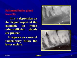 05/19/1605/19/16 OelshallOelshall 8282
Submandibular gland
fossa(4):
It is a depression on
the lingual aspect of the
mandible on which
submandibular glands
are present.
It appears as a zone of
radiolucency below the
lower molars.
 