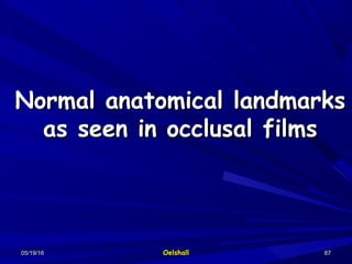 05/19/1605/19/16 OelshallOelshall 8787
Normal anatomical landmarksNormal anatomical landmarks
as seen in occlusal filmsas seen in occlusal films
 