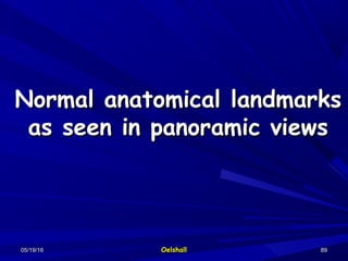 05/19/1605/19/16 OelshallOelshall 8989
Normal anatomical landmarksNormal anatomical landmarks
as seen in panoramic viewsas seen in panoramic views
 