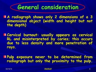 05/19/1605/19/16 OelshallOelshall 99
General considerationGeneral consideration
A radiograph shows only 2 dimensions of a 3A radiograph shows only 2 dimensions of a 3
dimensional object (width and height but notdimensional object (width and height but not
the depth)the depth)
Cervical burnout: usually appears as cervicalCervical burnout: usually appears as cervical
RL and misinterpreted by caries; this occursRL and misinterpreted by caries; this occurs
due to less density and more penetration ofdue to less density and more penetration of
rays.rays.
Pulp exposure never to be determined fromPulp exposure never to be determined from
radiograph but only the proximity to the pulp.radiograph but only the proximity to the pulp.
 