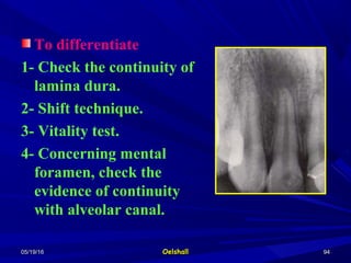 05/19/1605/19/16 OelshallOelshall 9494
To differentiate
1- Check the continuity of
lamina dura.
2- Shift technique.
3- Vitality test.
4- Concerning mental
foramen, check the
evidence of continuity
with alveolar canal.
 