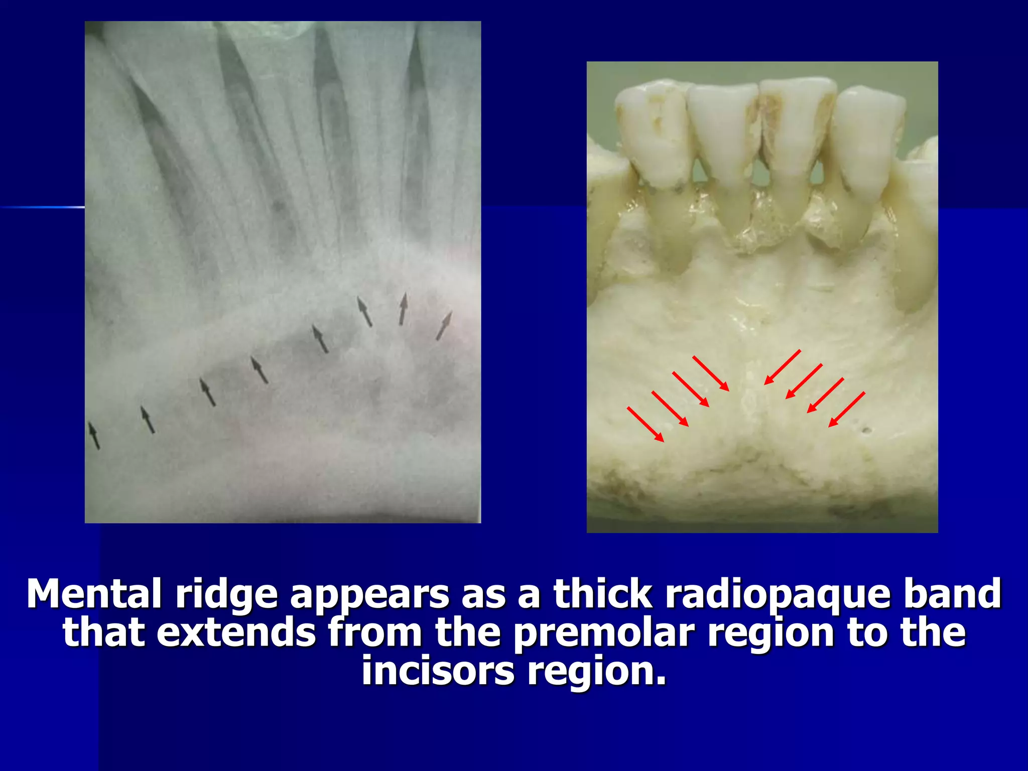 Radiographic Anatomical Landmarks | PPSX
