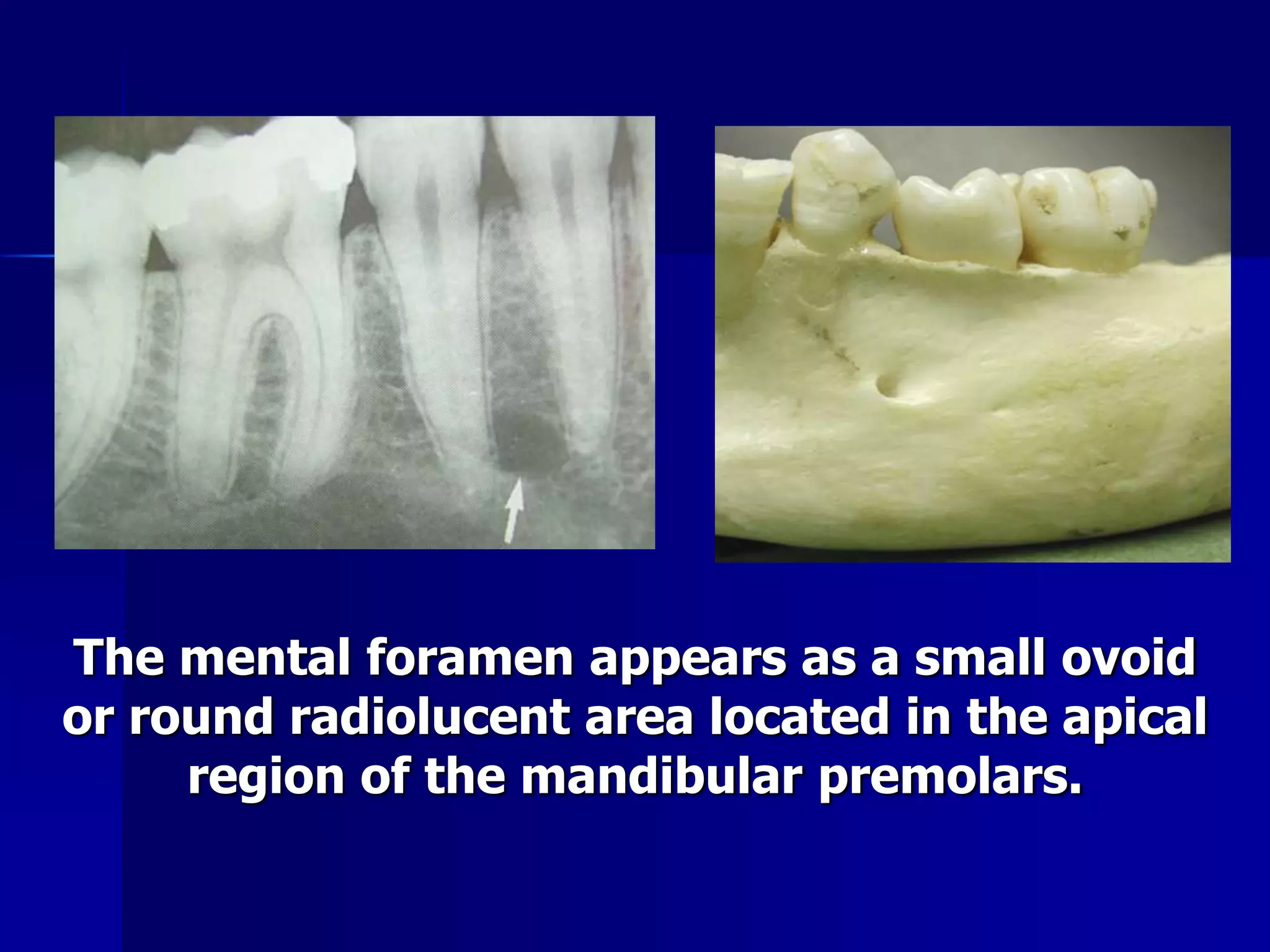 Radiographic Anatomical Landmarks | PPSX