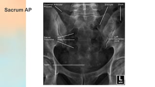 Anatomi Radiologi Rangka Dada dan Tulang Belakang: Struktur dan Fungsi ...