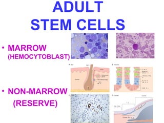 ADULT 
STEM CELLS 
• MARROW 
(HEMOCYTOBLAST) 
• NON-MARROW 
(RESERVE) 
 