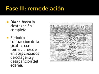  Día 14 hasta la
cicatrización
completa.
 Período de
contracción de la
cicatriz con
formaciones de
enlaces cruzados
de colágeno y
desaparición del
edema.
 