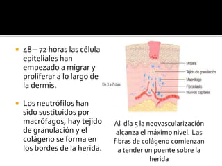  48 – 72 horas las células
epiteliales han
empezado a migrar y
proliferar a lo largo de
la dermis.
 Los neutrófilos han
sido sustituidos por
macrófagos, hay tejido
de granulación y el
colágeno se forma en
los bordes de la herida.
Al día 5 la neovascularización
alcanza el máximo nivel. Las
fibras de colágeno comienzan
a tender un puente sobre la
herida
 