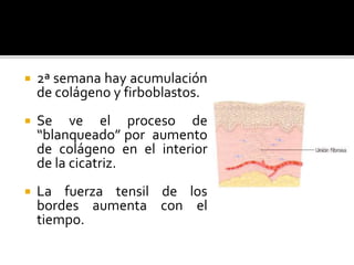  2ª semana hay acumulación
de colágeno y firboblastos.
 Se ve el proceso de
“blanqueado” por aumento
de colágeno en el interior
de la cicatriz.
 La fuerza tensil de los
bordes aumenta con el
tiempo.
 